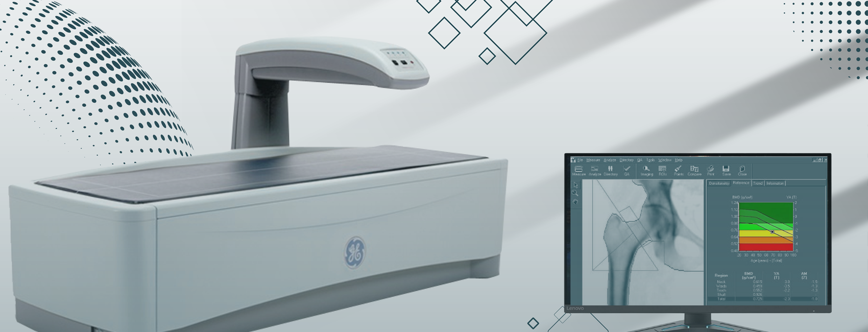 Bone Density Scan (DEXA Scan) Machine at Images Diagnostic Center