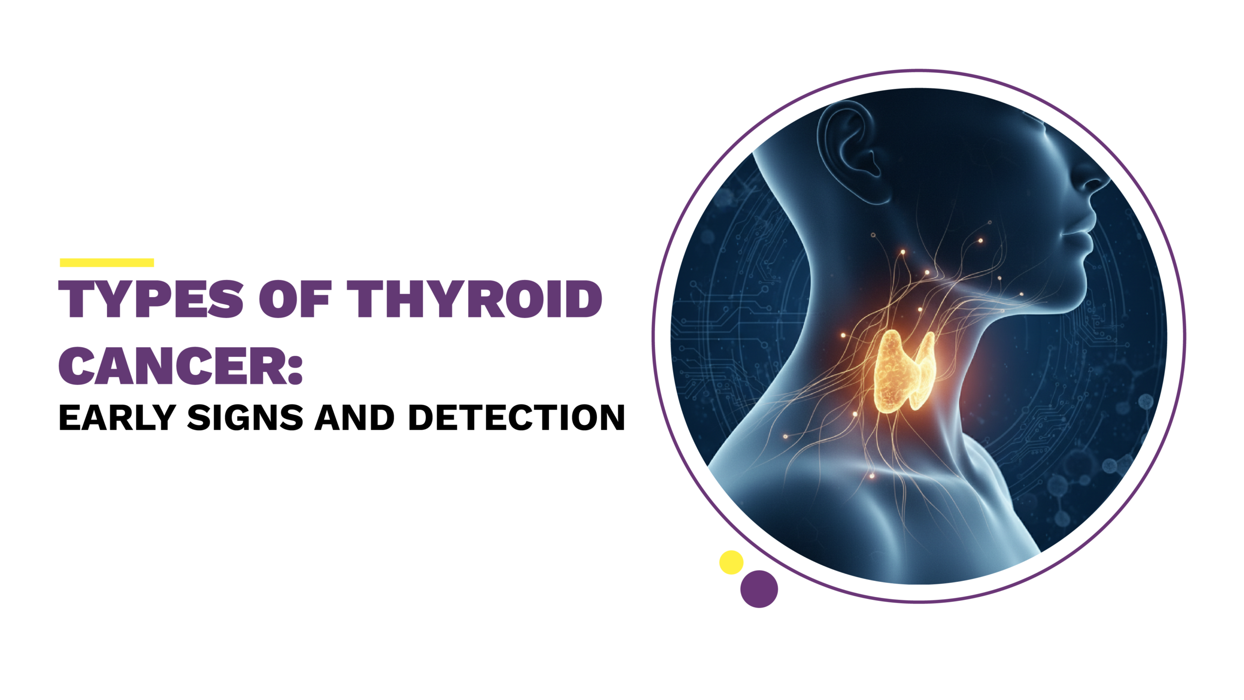 types of thyroid cancer