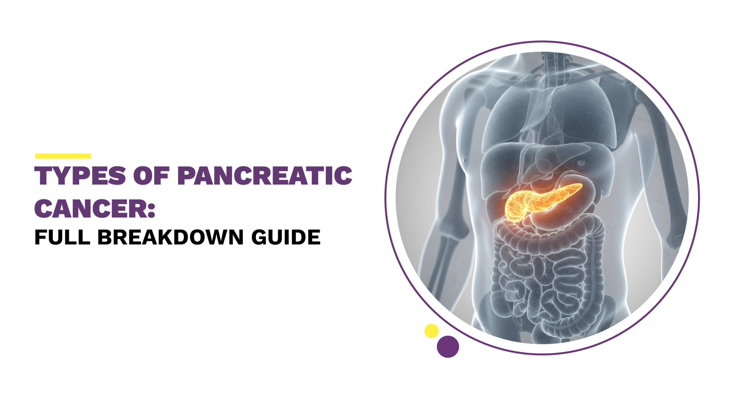 types of pancreatic cancer