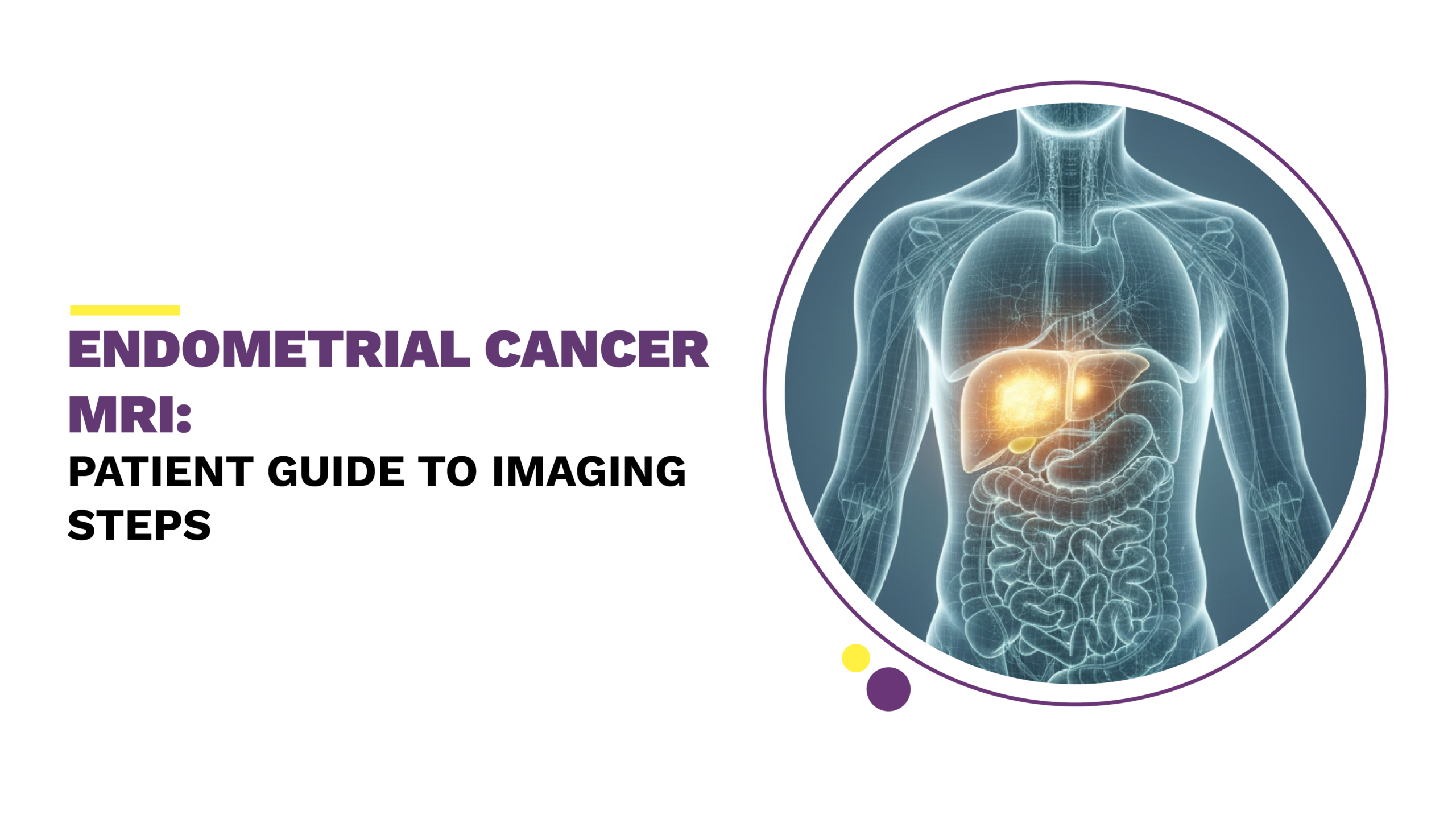 endometrial cancer mri