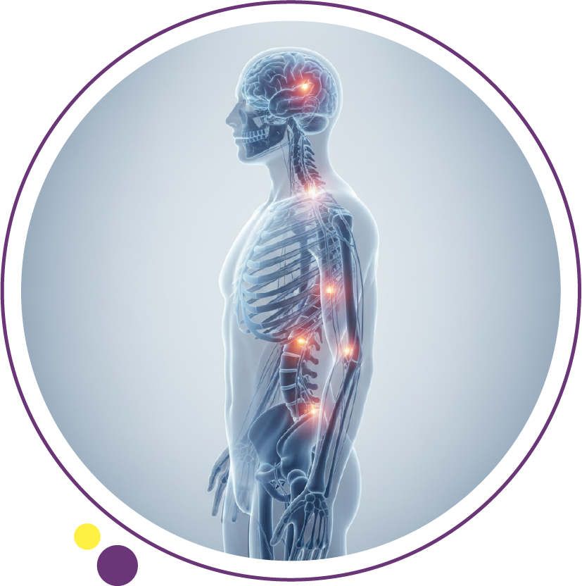 اعراض التصلب اللويحي