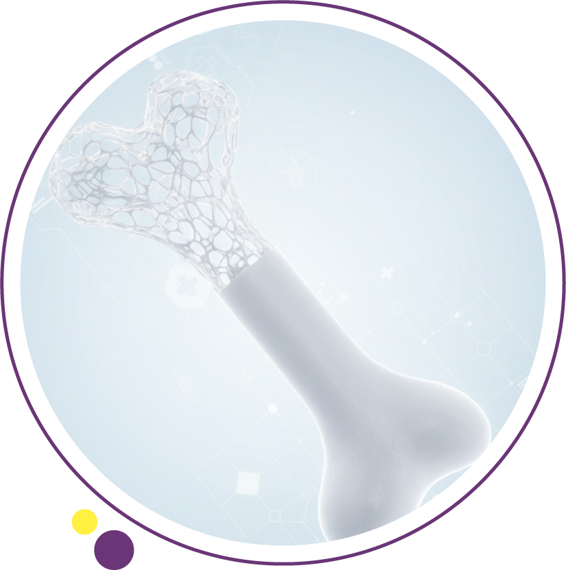 هشاشة العظام