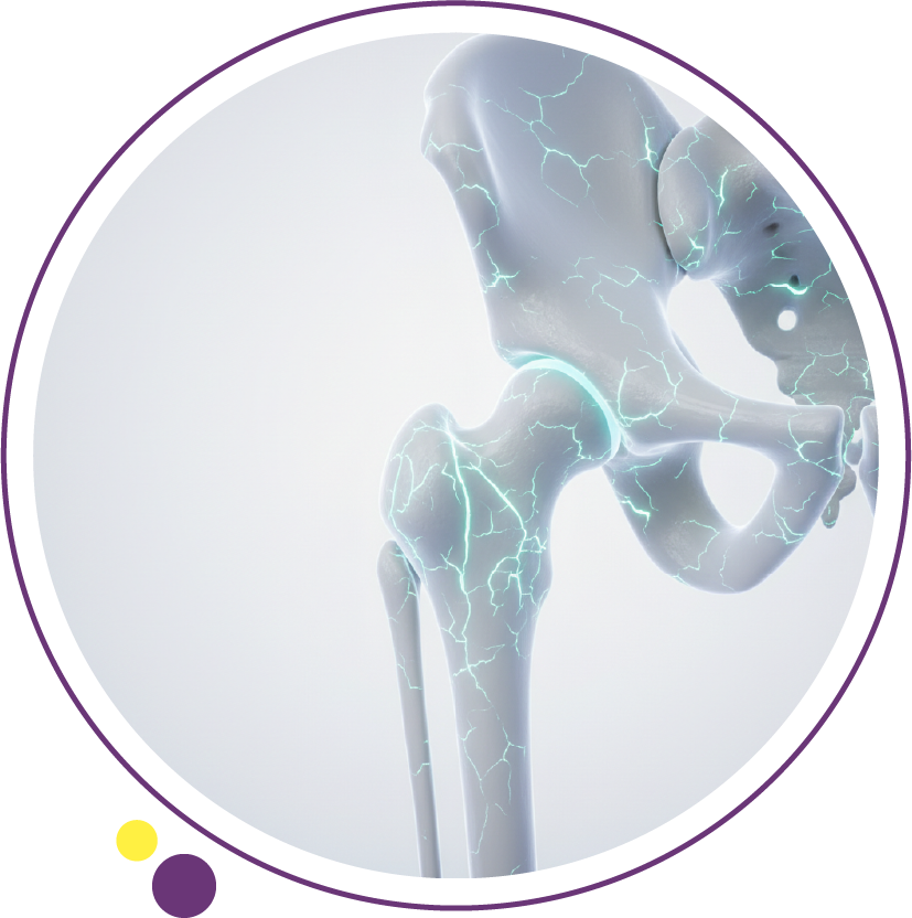 اعراض هشاشة العظام