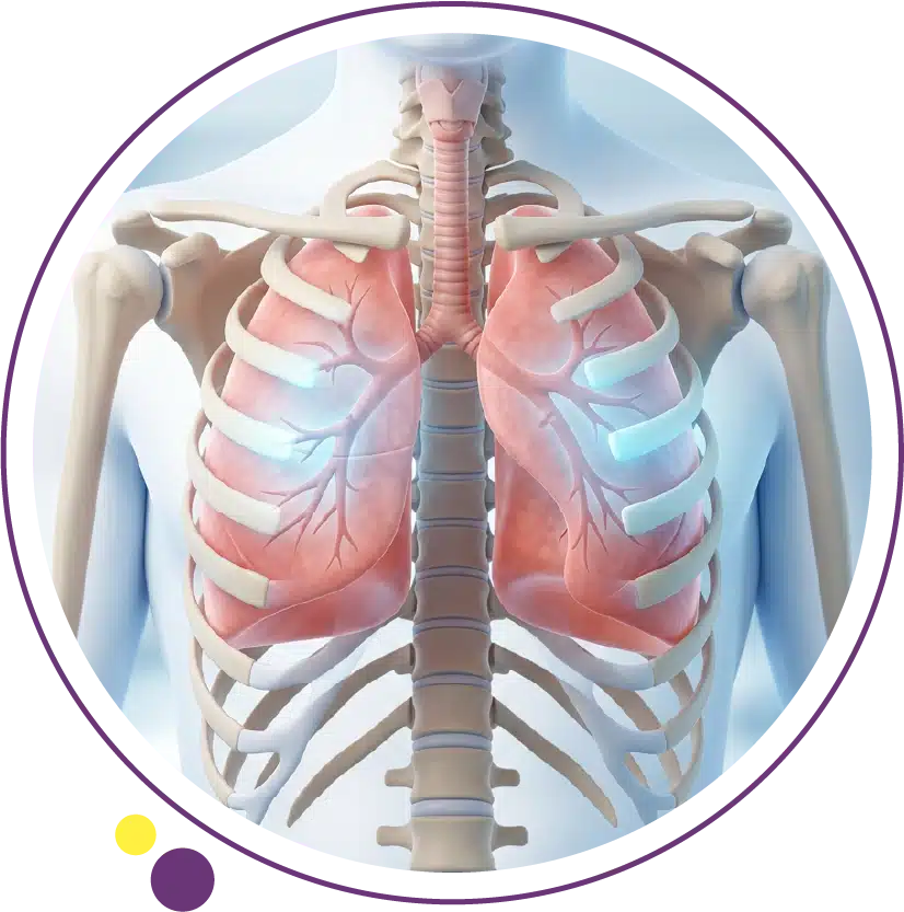 lung cancer