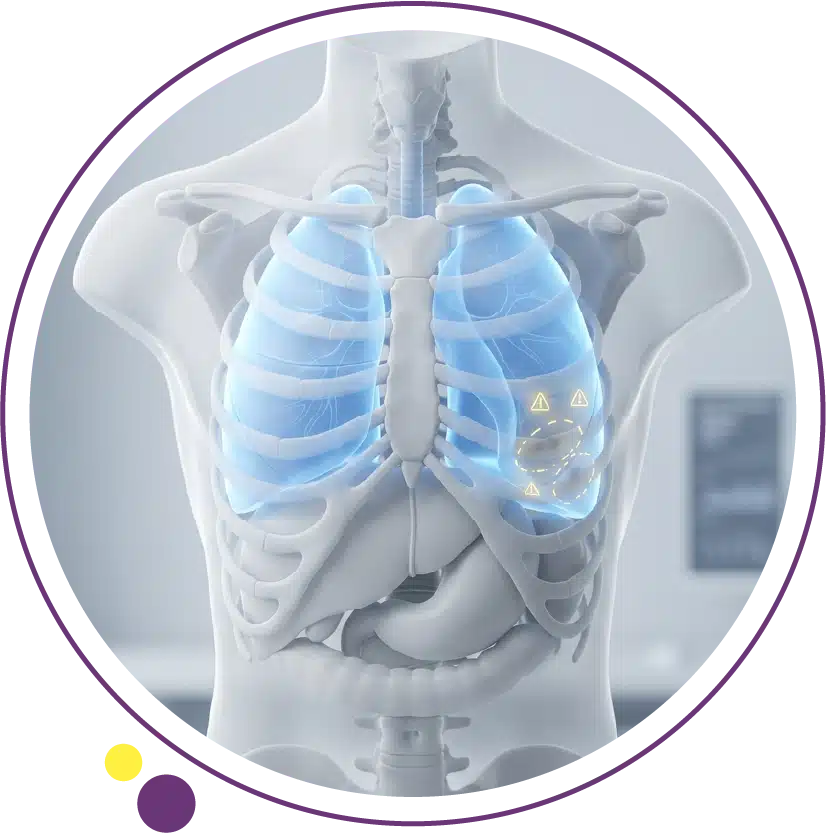 lung cancer symptoms