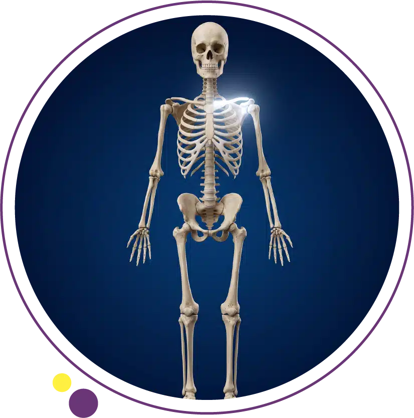 bone cancer