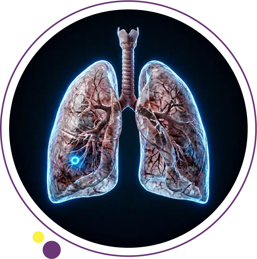 how to know if you have lung cancer