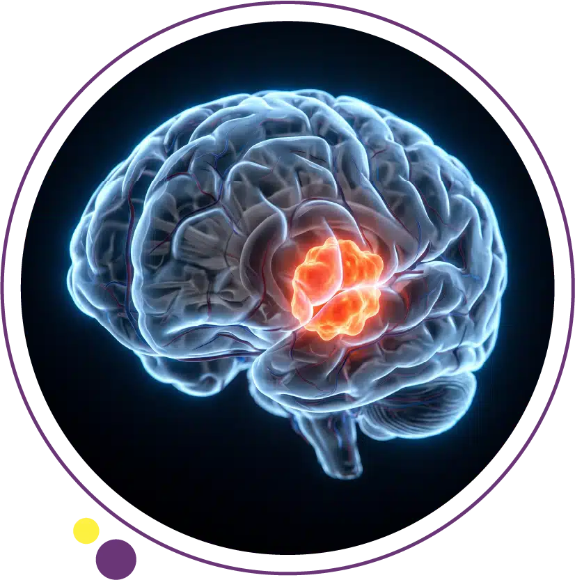 brain tumor symptoms
