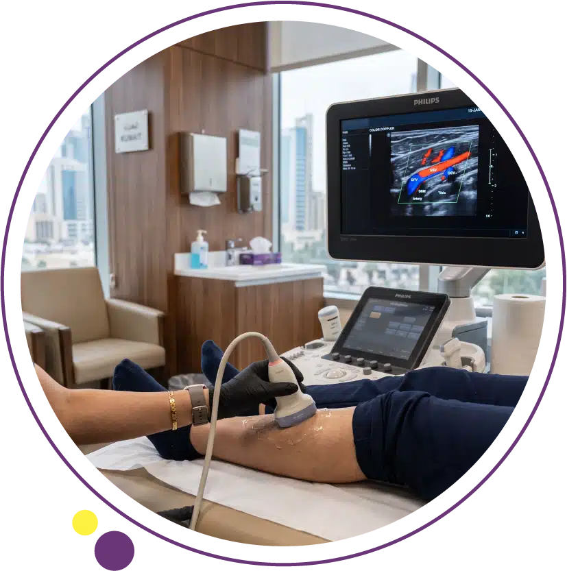 doppler ultrasound